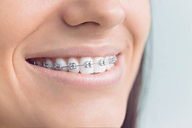 Best Traditional Braces  in Mount Vernon, MD